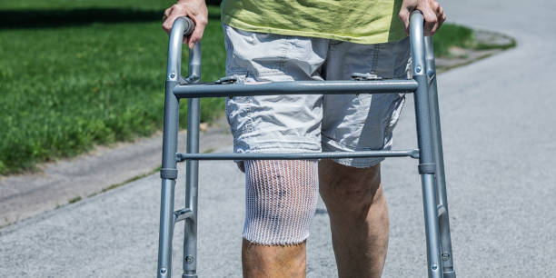 Recovery after knee replacement